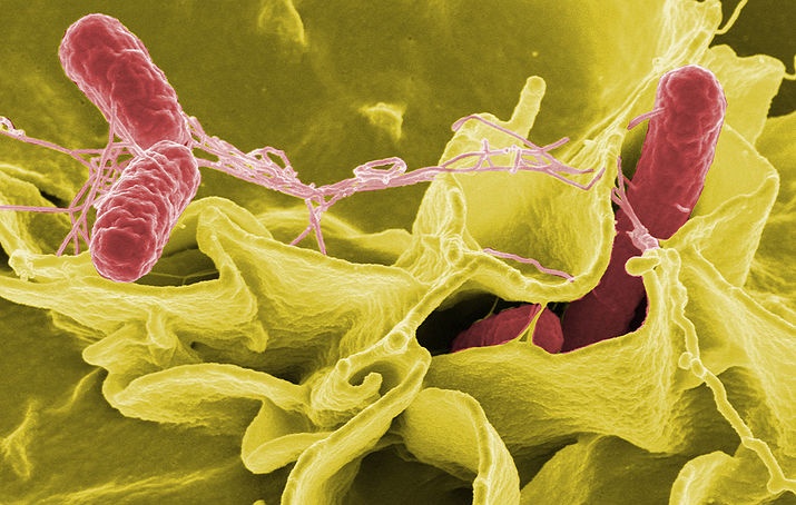 Salmonella w przedszkolu - Źródło: wikipedia.org / Rocky Mountain Laboratories