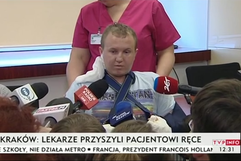 Gilotyna obcięła mu dłonie, dziś rusza palcami. Lekarze z Krakowa dokonali cudu  - foto: kadr z konferencji prasowe / TVP INFO