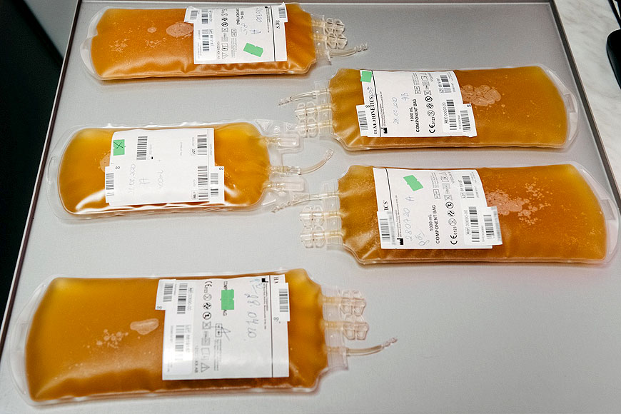 Apel do ozdrowieńców po COVID-19 o oddawanie osocza krwi