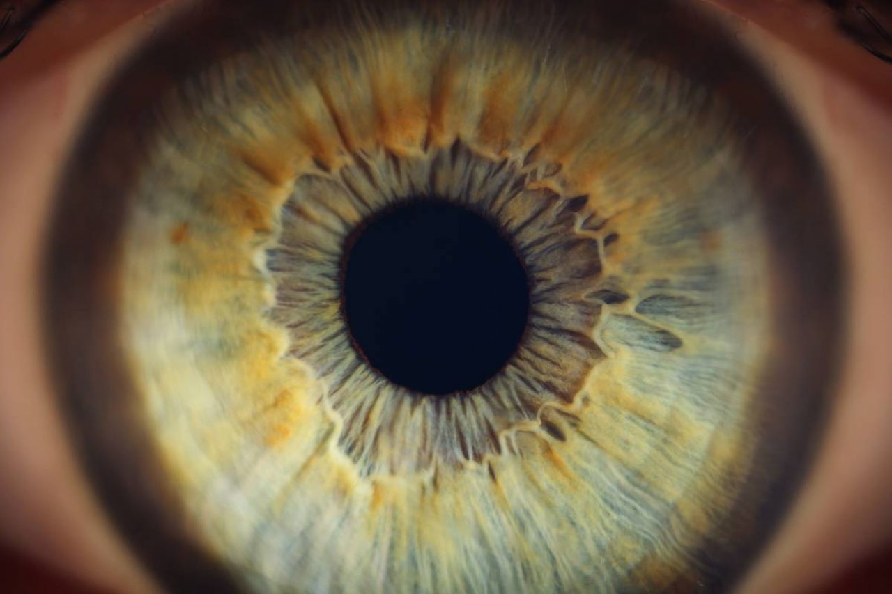 Zwyrodnienie plamki żółtej – jak rozpoznać pierwsze objawy i szybko zareagować?